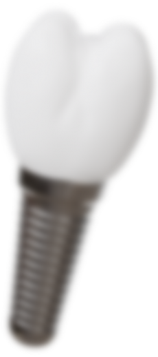 dental implant-2@2x